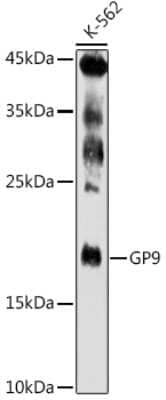 Western Blot: GP-IX AntibodyAzide and BSA Free [NBP3-03507]